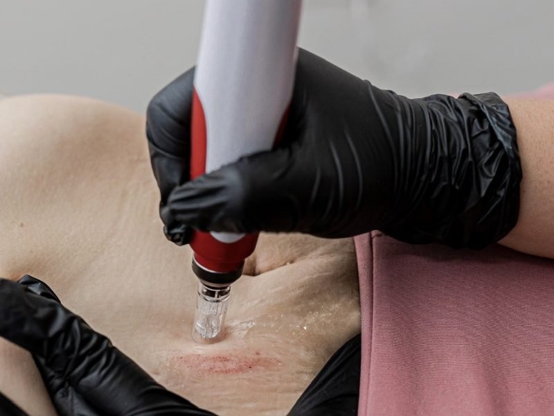 DanielaArevaloFisioterapeuta (21)